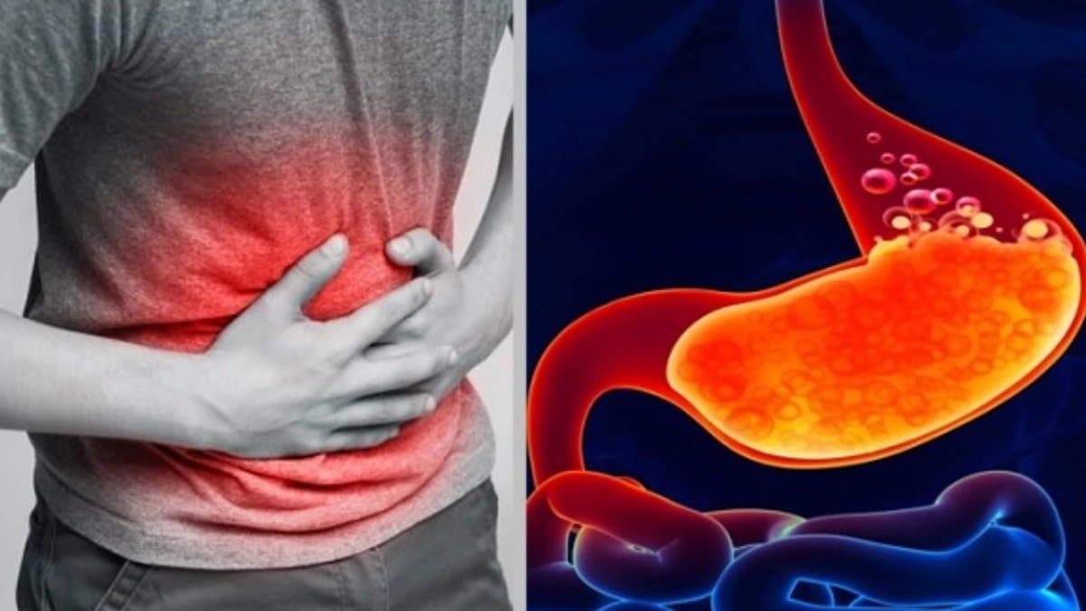 These common Kitchen seeds cure constipation and improve gut health 