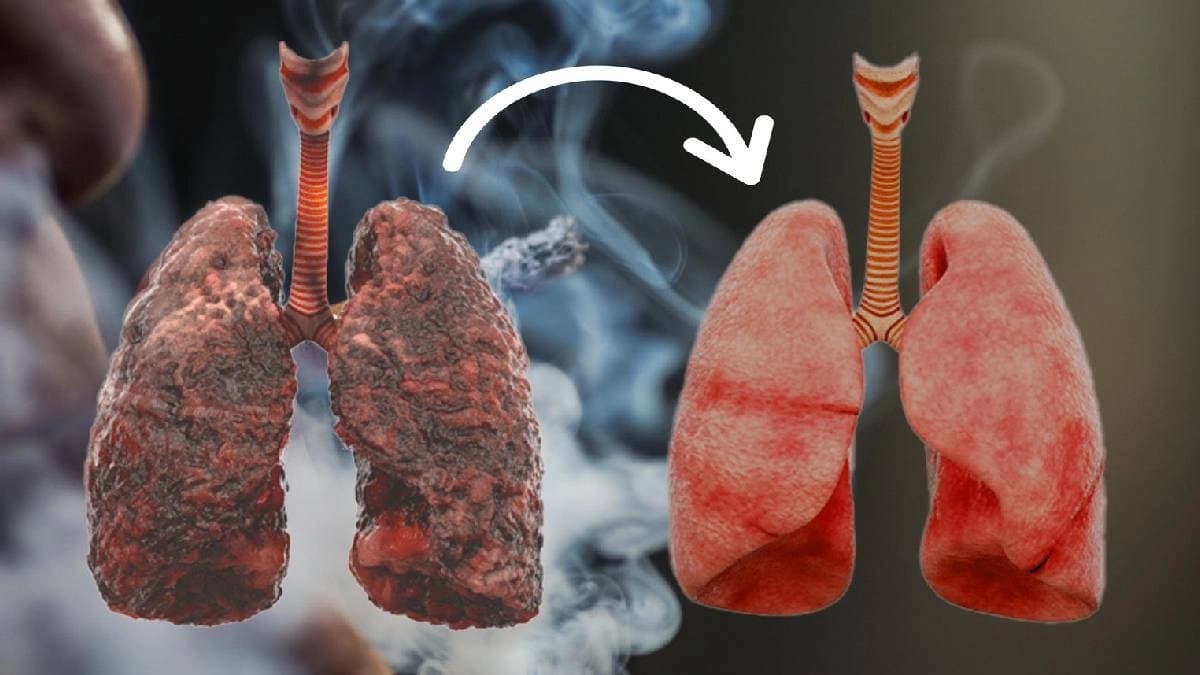 How to take care of your lungs after you quit smoking
