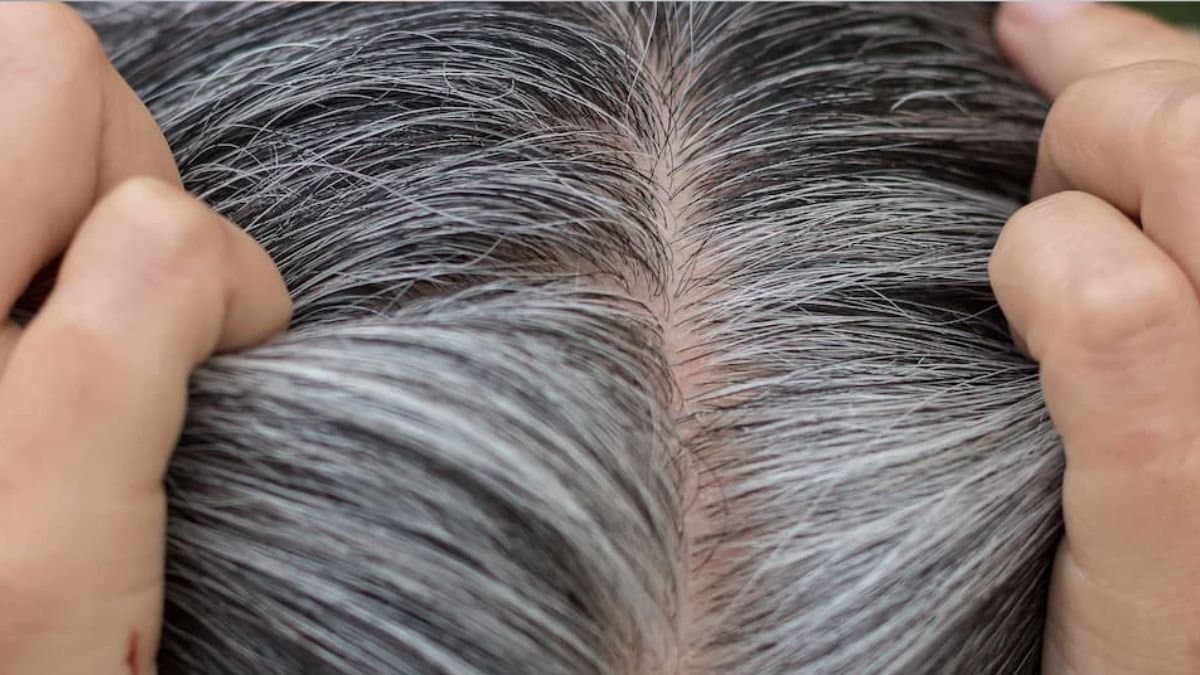 Why grey hair is good for health