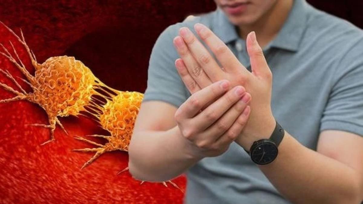 Cancer Symptoms: These warning signs of lung cancer can show up in your fingers