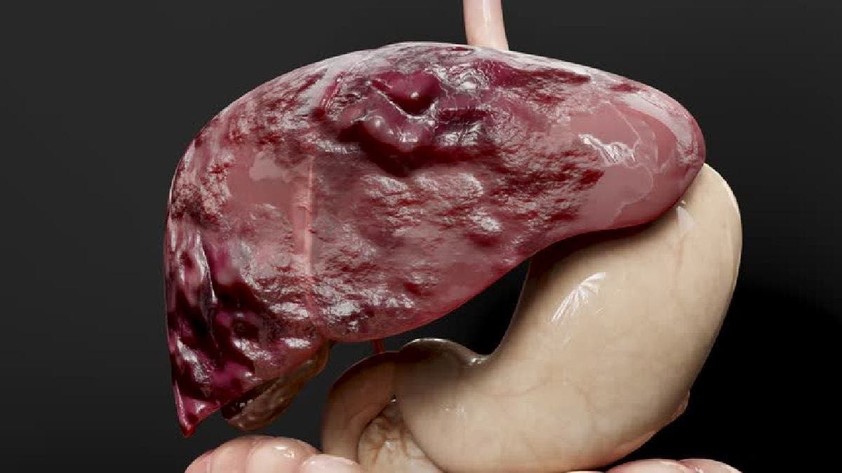 Beetroot amla green tea among top detox Drink for Liver Health