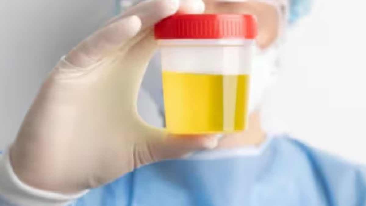 Model Claims Drinking His Own Urine Keeps Him Healthy viral news