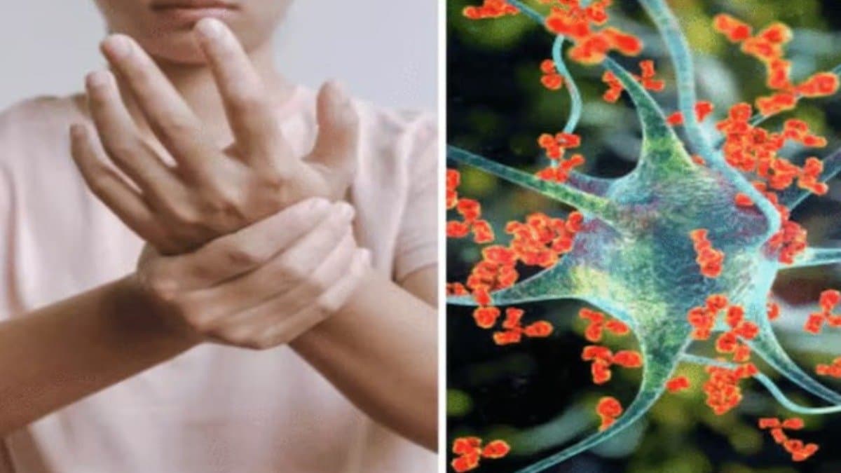 these foods should avoid to prevent guillain barre syndrome know other precautions details insid lif