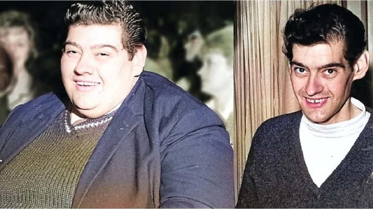 Flashback: When a man fasted for 382 days to lose 125 kilo weight