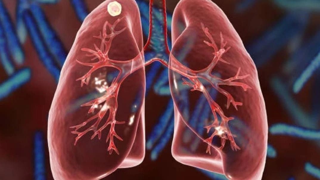 These everyday foods damage respiratory health and make breathing tough