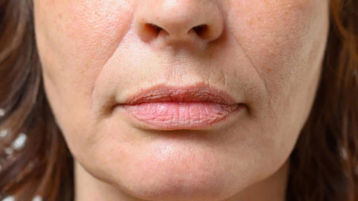 This vitamin deficiency causes wrinkles on face know what should you eat