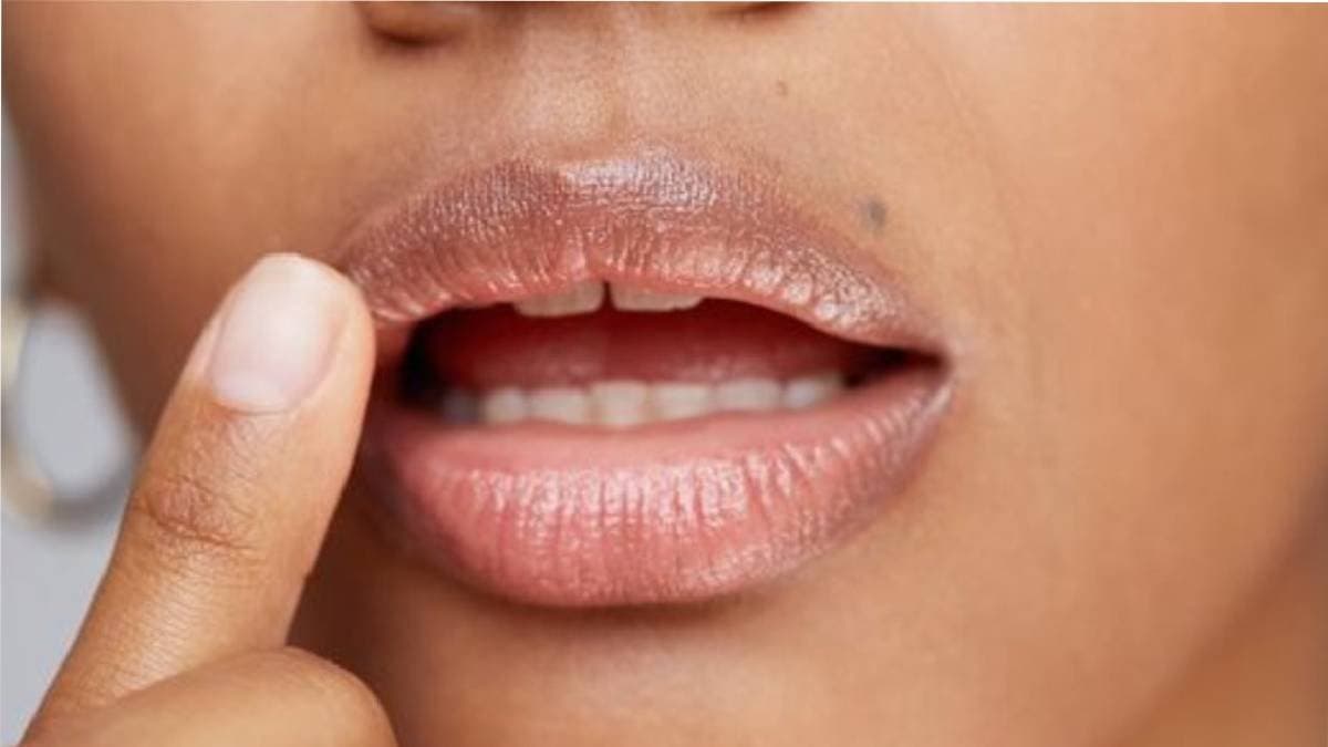 what is the reason of dark patches on lips lif