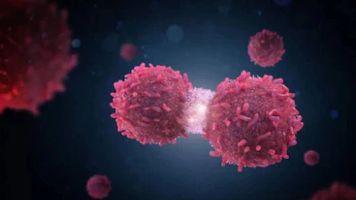  5 biggest signs of stomach cancer 