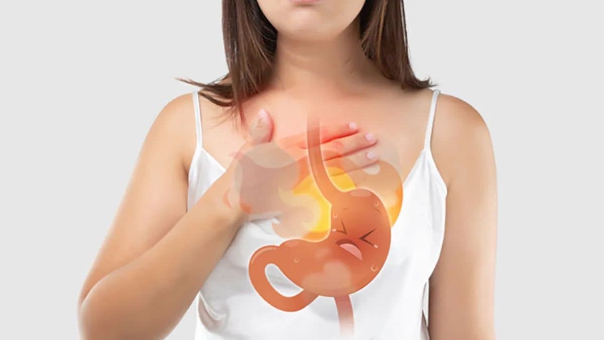 GERD: Acid Reflux home remedies Acidity Remedy