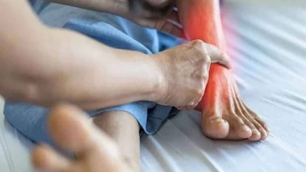 How to cure uric acid with home remedies