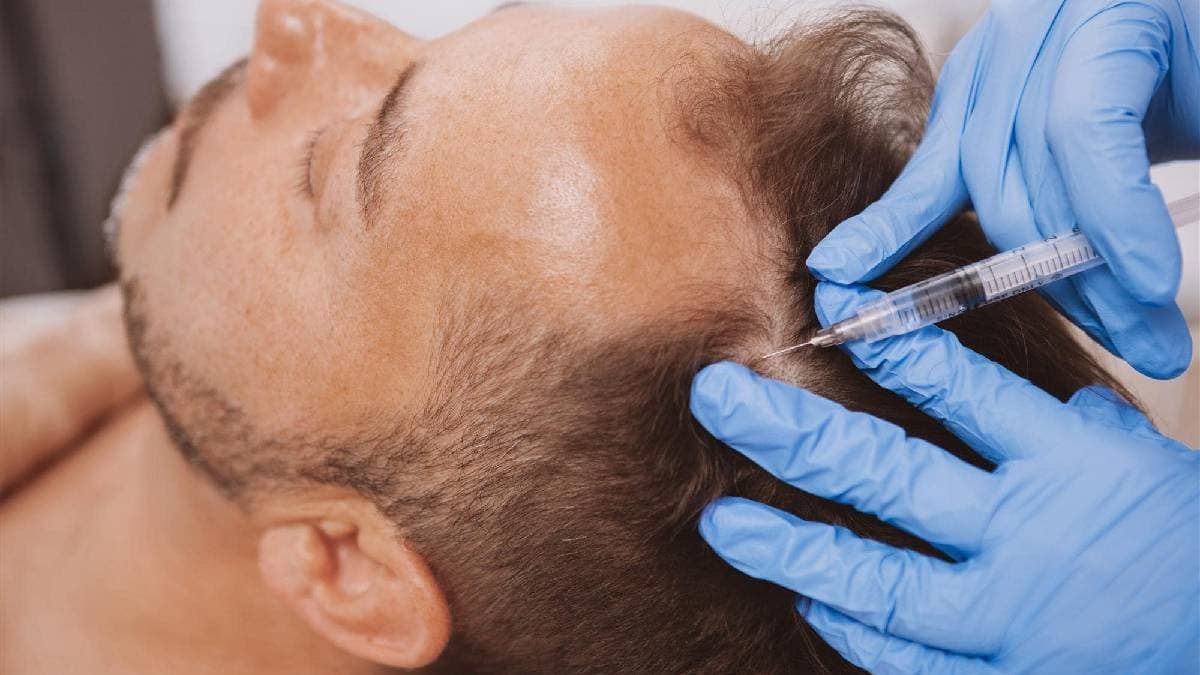 Platelet Rich Plasma Therapy cost and effectiveness