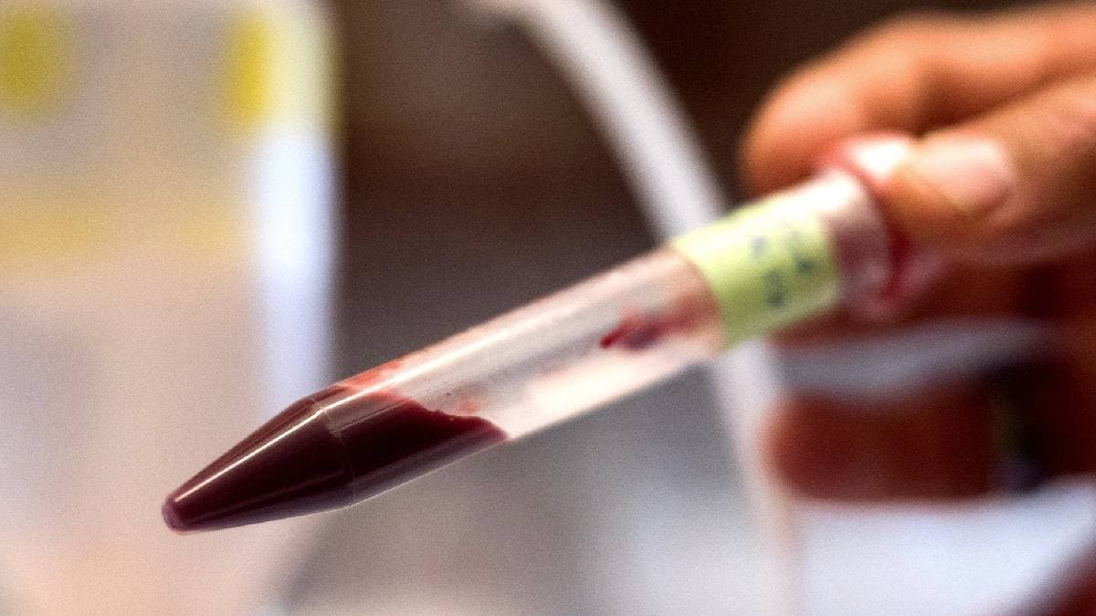 Japanese Scientists create Artificial Blood for medical use