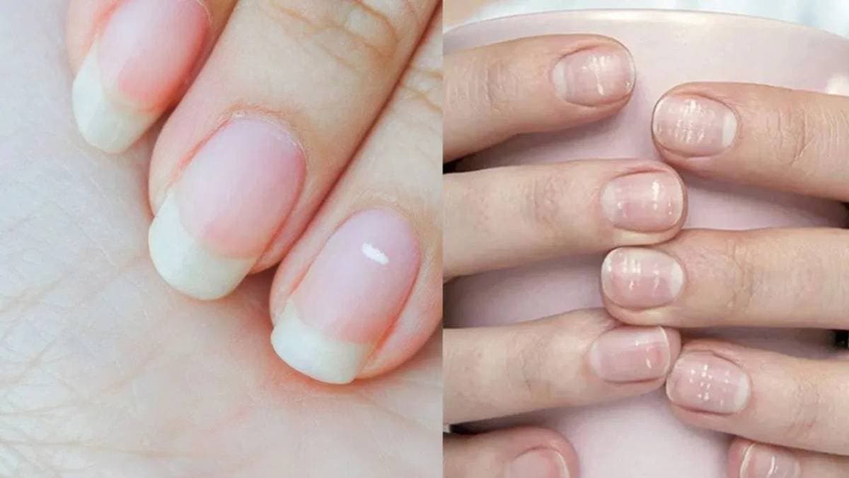  what is the reason of white spot on nail details inside lif