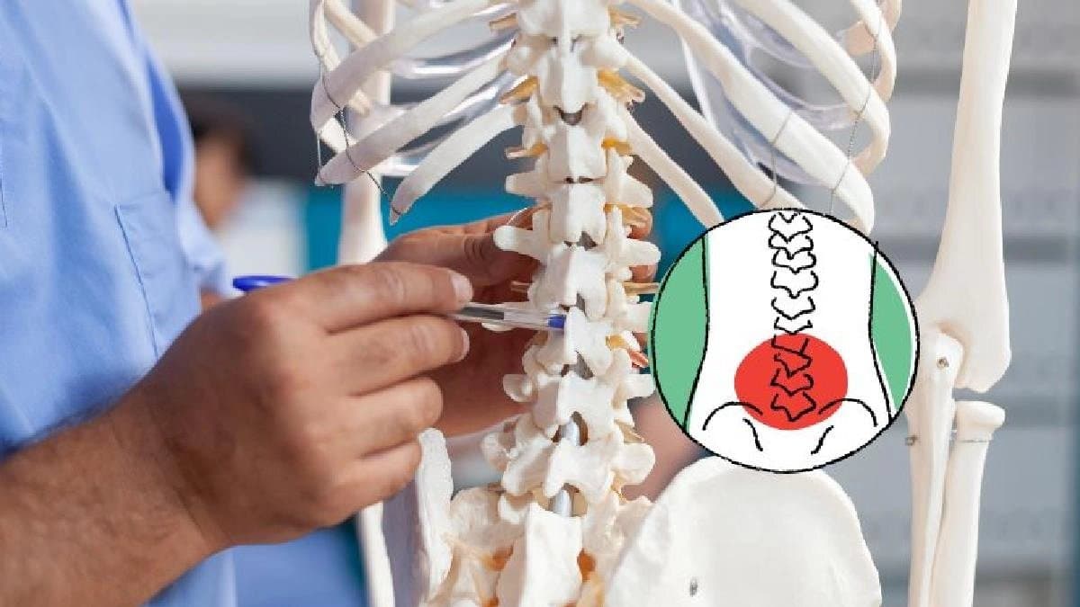 কিছুতেই কমছে না পিঠের ব্যথা? জানেন টিবি হতে পারে মেরুদণ্ডেও? কীভাবে চিনবেন স্পাইনাল টিউবারকুলোসিস?