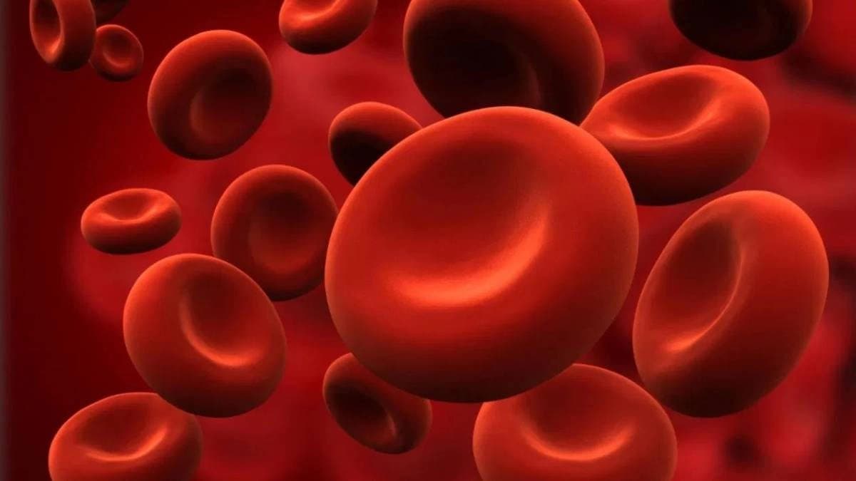 These unusual signs of Iron deficiency should not be ignored