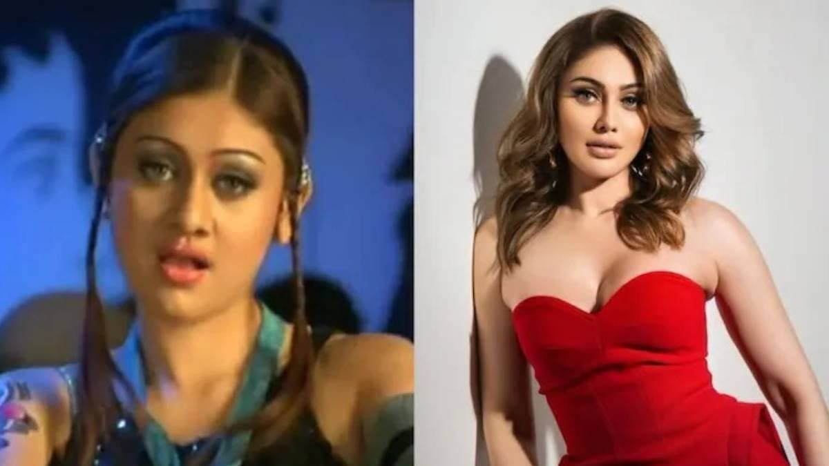 Shefali Jariwala Death kaanta laga fame actress suffered from epilepsy depression at the age of 15 