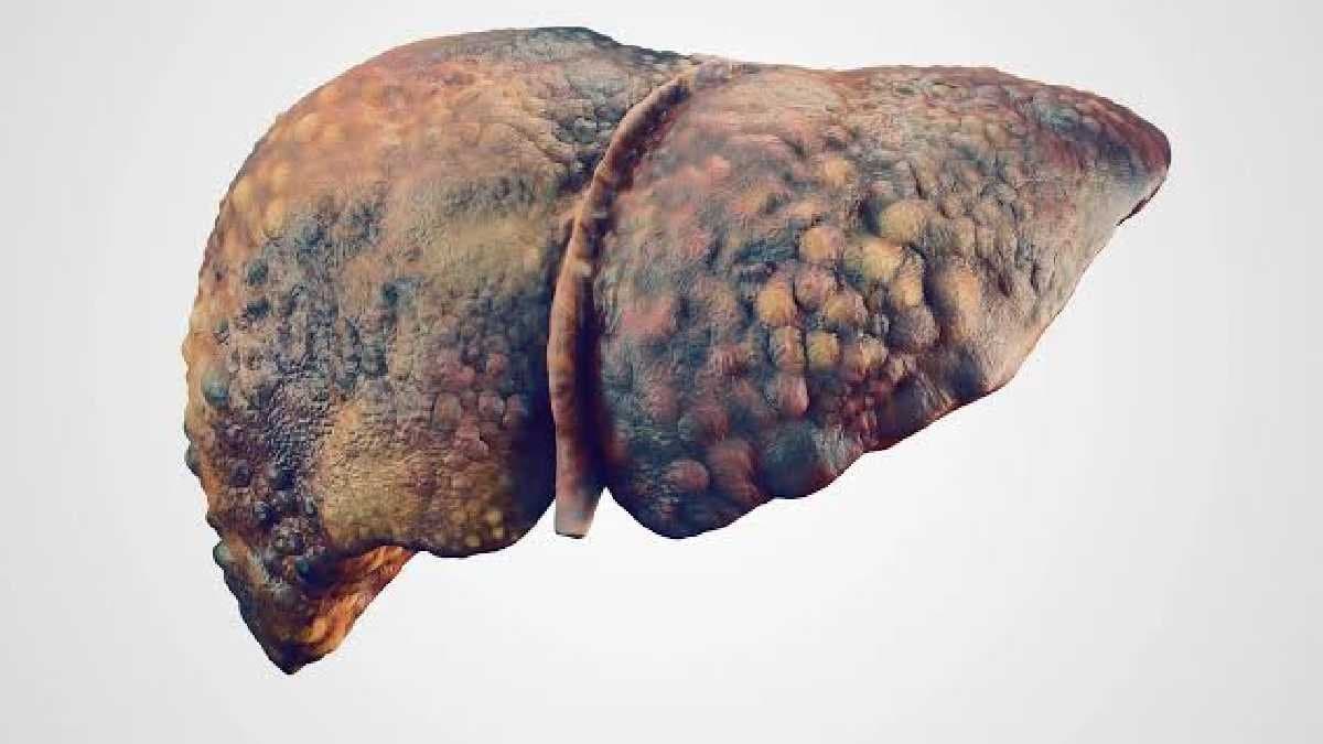 শুধু মদ নয়, লিভারের ভয়ঙ্কর সর্বনাশ করে রোজকার এই পানীয়! বাঁচতে চাইলে ভুলেও ছোঁবেন না