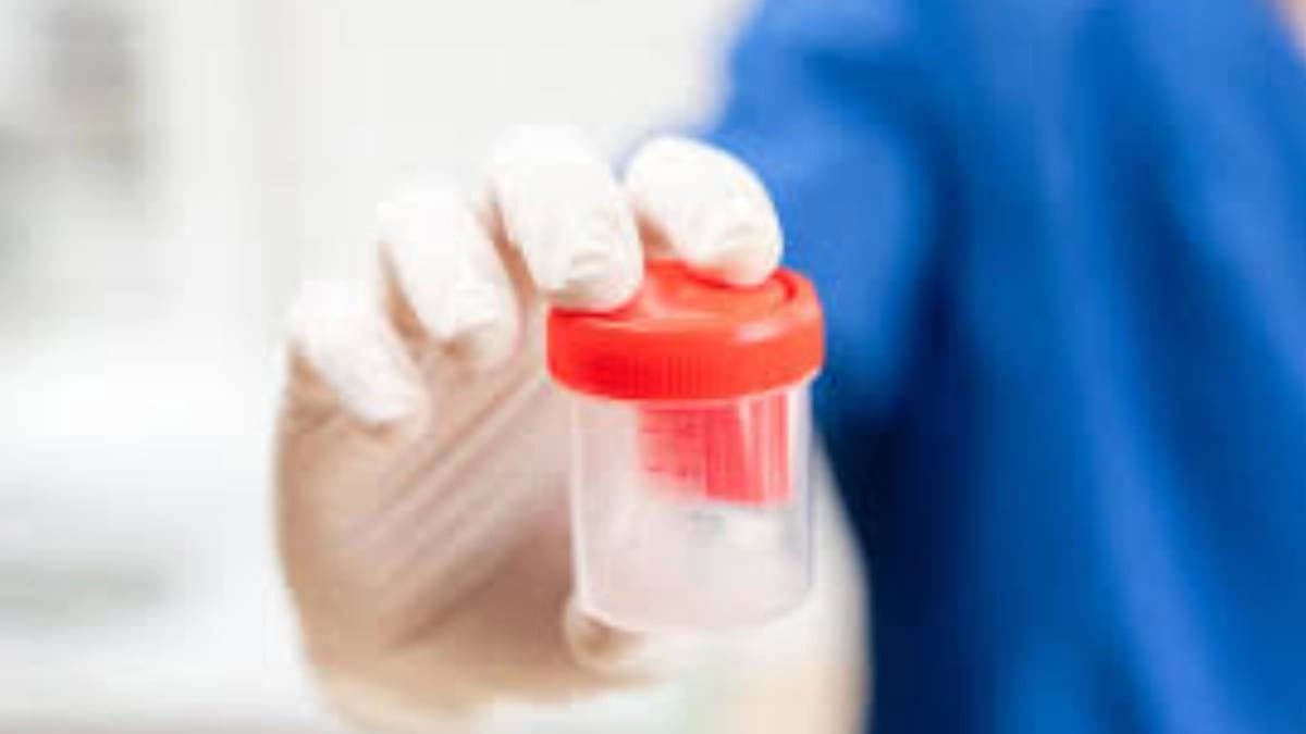 Fraud IVF clinics hiring beggars to collect sperm