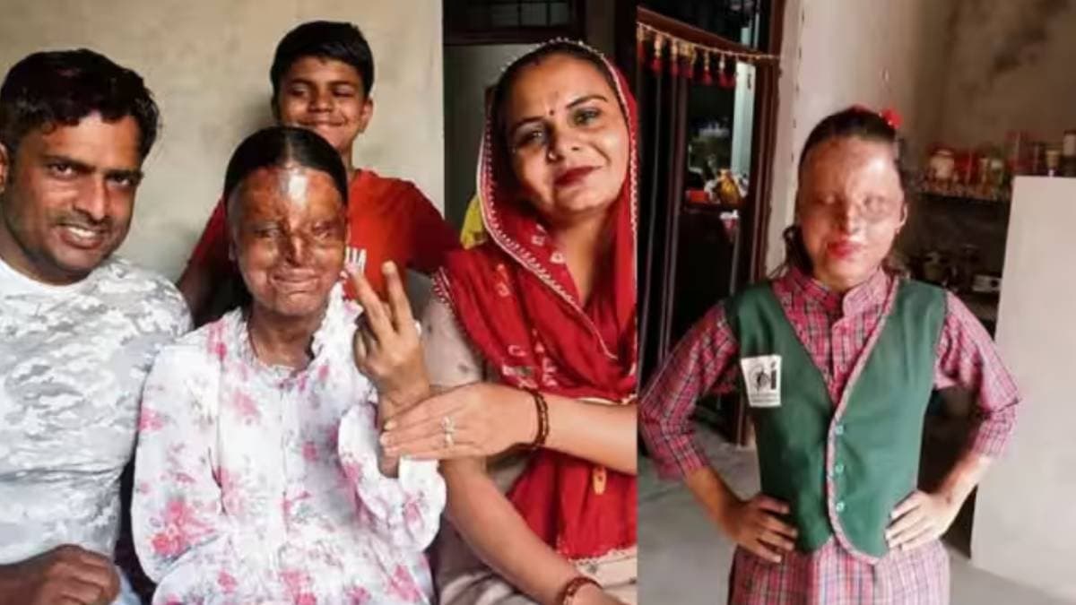 The story of Kafi from Hisar being a victim of an acid attack to scoring to grade at a blind school in Chandigarh.