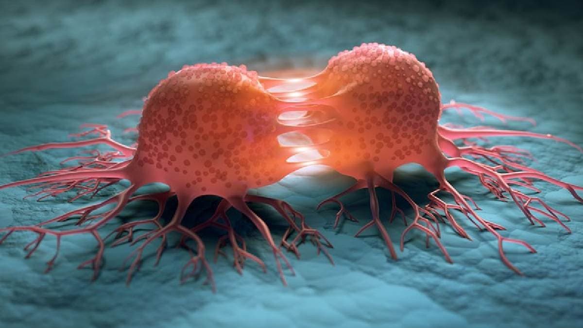 With bone marrow transplantation NRS Hospital cured a critical cancer patient