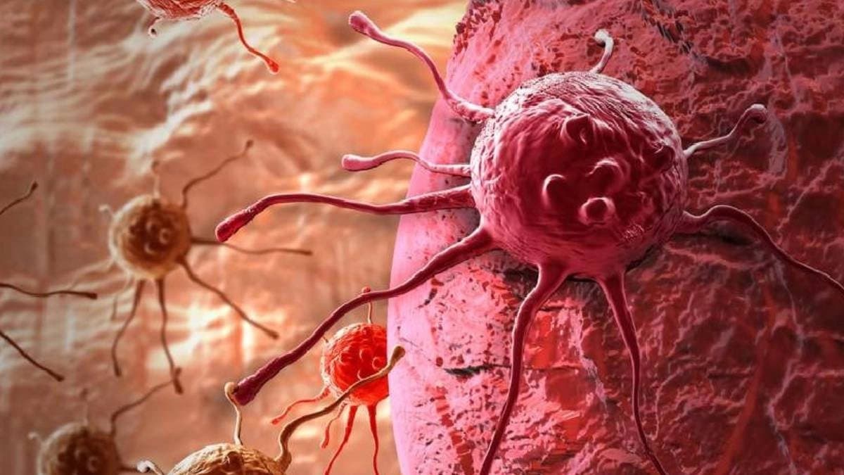 Cancer Symptoms: pain in these parts of the body indicate cancer