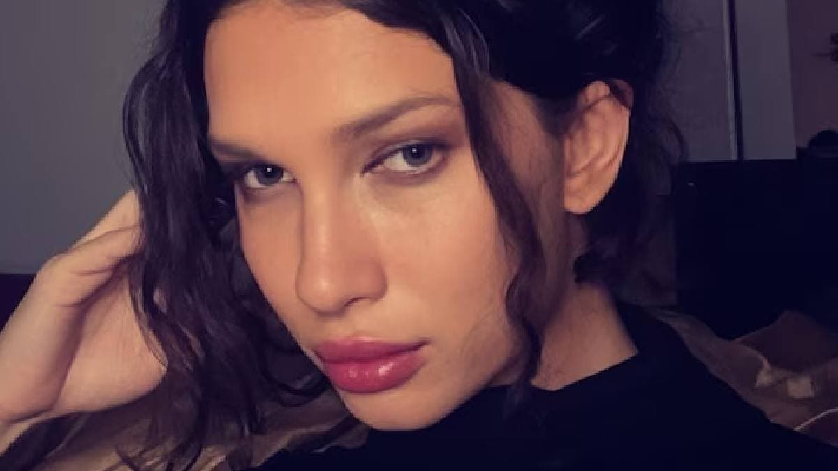 বিড়ালের মত চেহারা তো হলই না বরং জলে গেল ৬ লক্ষ টাকা, জানেন কী হয়েছিল অস্ট্রেলিয় তরুণী সঙ্গে?