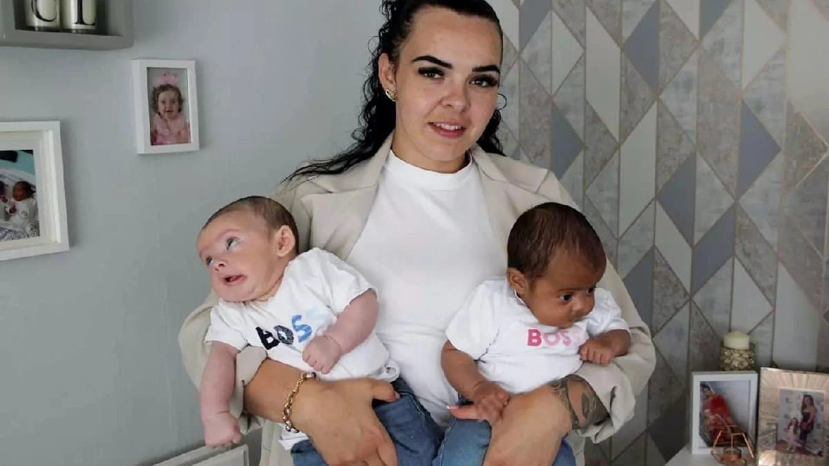 Woman gives birth to twin child with different fathers in a Rare Medical Condition