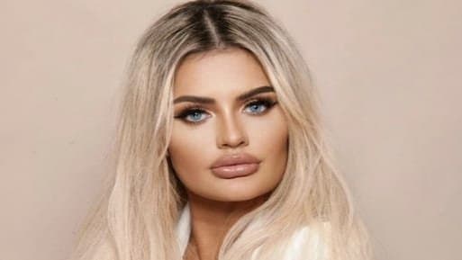 Model Banned From Friends Christmas Dinner For Being Too Attractive gnr 