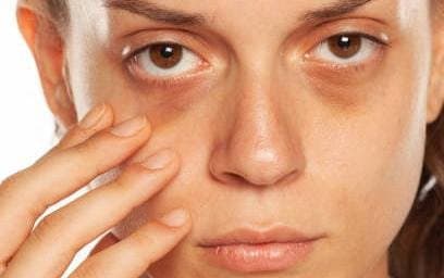 By applying this home made pack can prevent your dark circles and help to glow your skin very soon lif