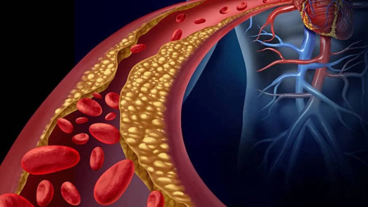 Pain in these parts of body may be high Cholesterol symptoms  