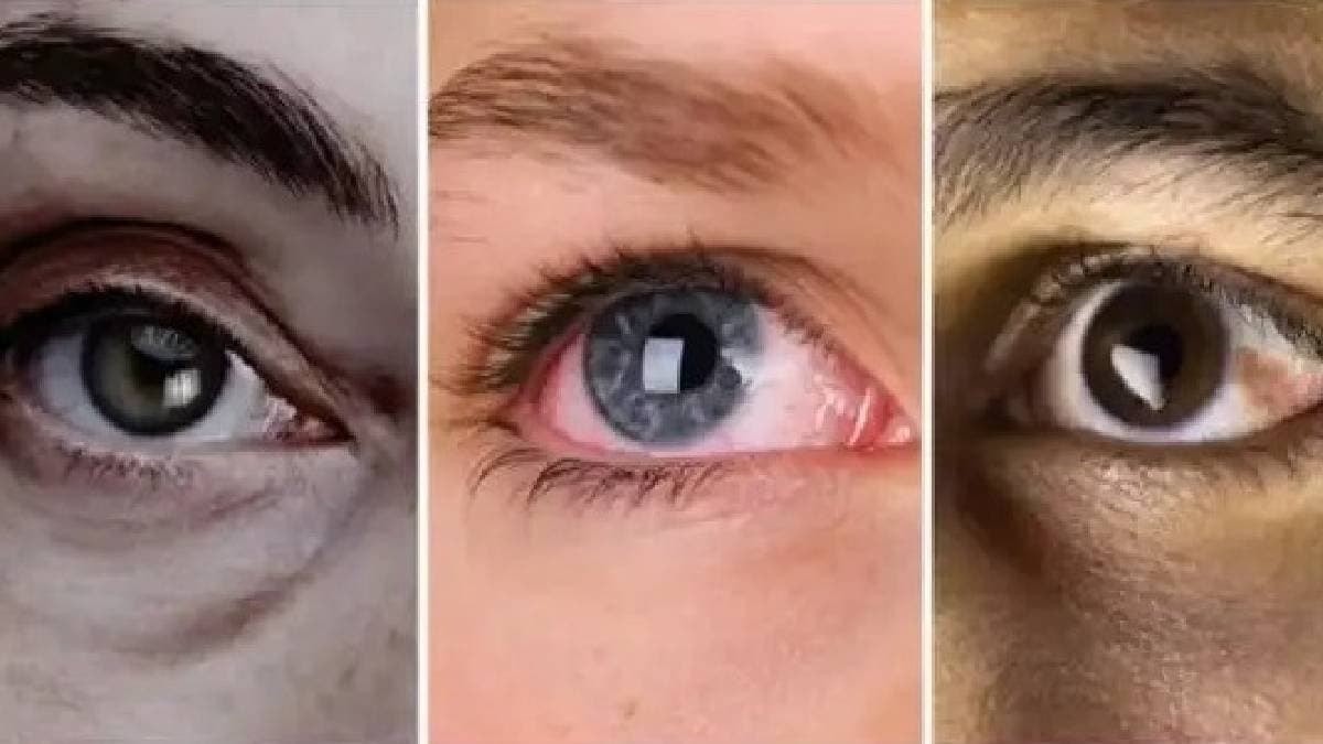 Health Tips: Your eyes can reveal these diseases symptoms