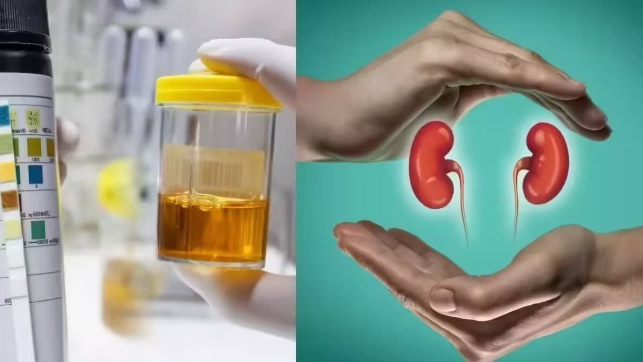 These symptoms of urine can indicate Kidney disease