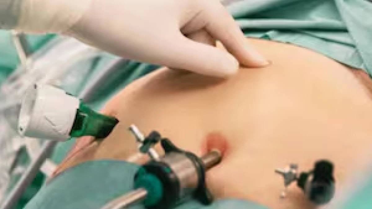 Surgical Cloth Found In Ghaziabad Woman's Stomach Days After C-Section