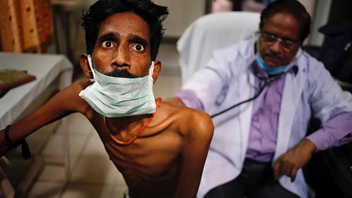 What are the differences between common cough and tuberculosis Symptoms