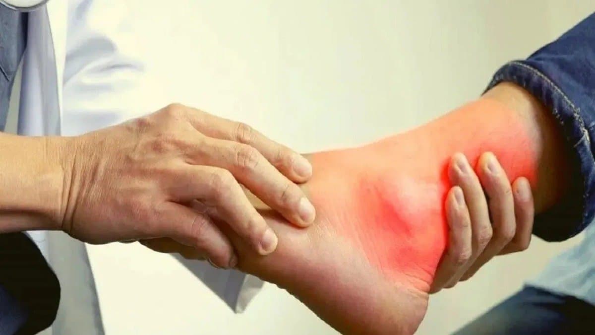  5 effective natural ways to reduce uric acid levels details inside