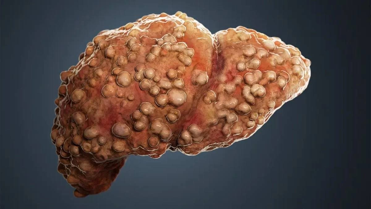 Cholesterol Reduction and Liver Detox among top benefits of Ginger