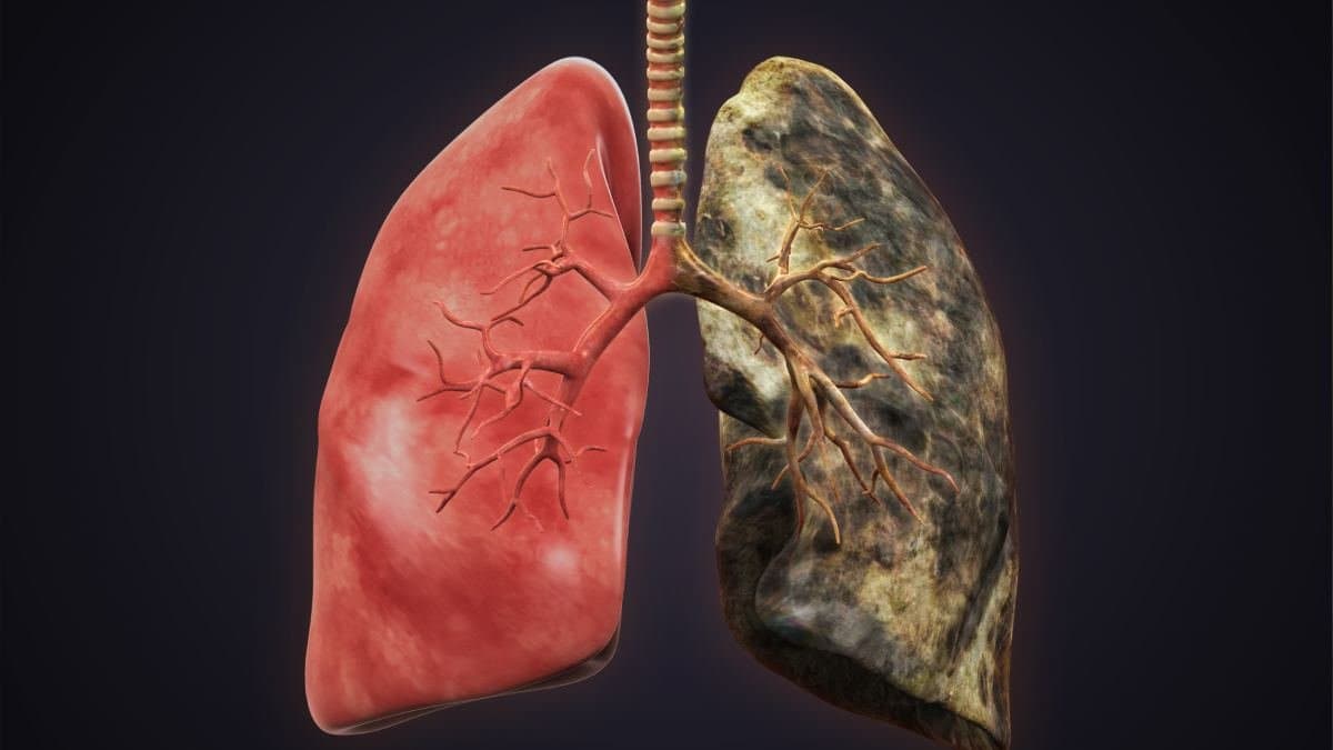 Five tips to take care of your lungs during summer