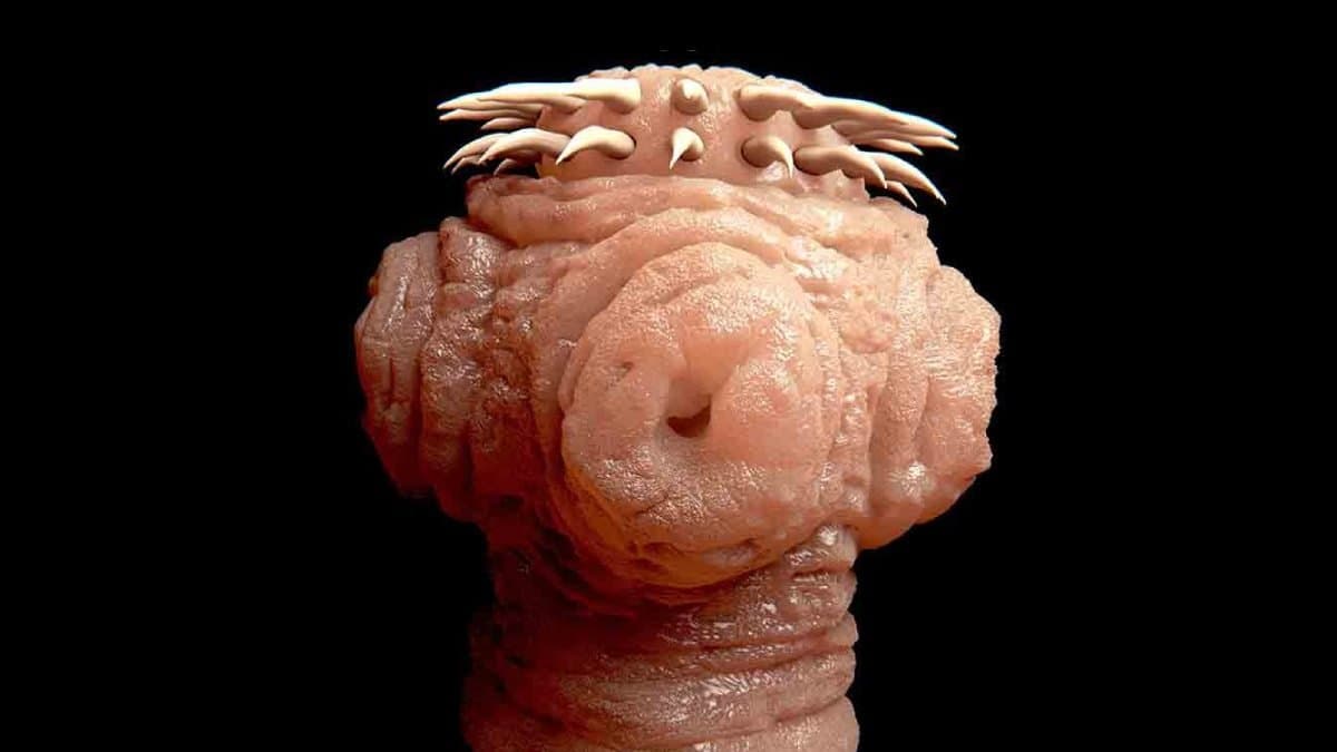 Some Doctors are concerned about bizarre Fox Tapeworm contamination