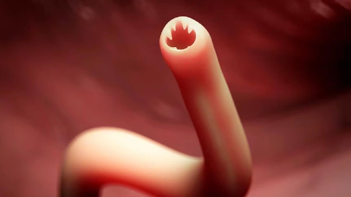 How dangerous is the bizarre fox Tapeworm contamination for human