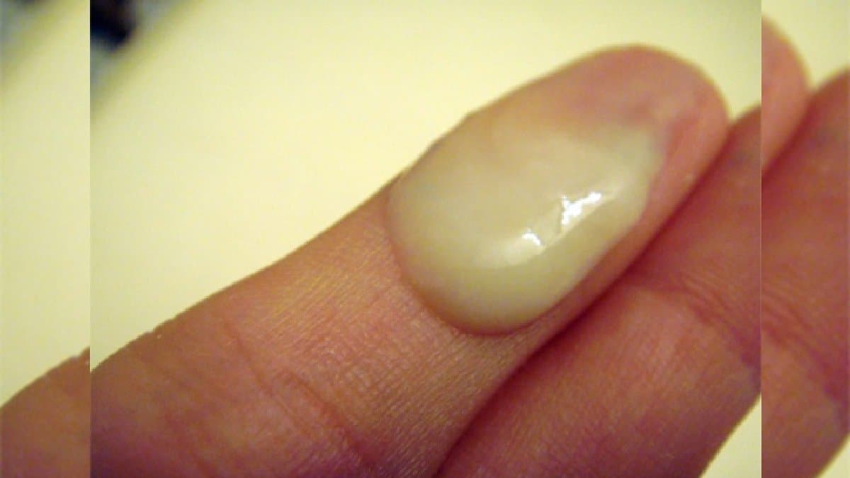 Lemon and honey with ginger can help cough and cold Home Remedy