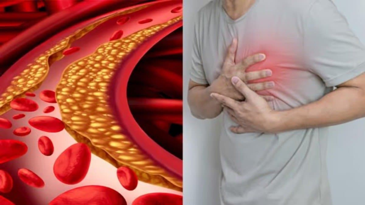 these foods will increase risk of heart disease in winter if your cholesterol is high lif