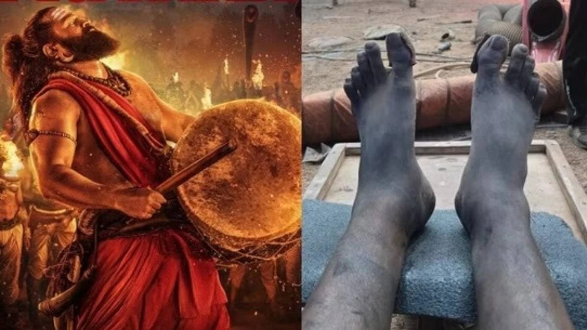 Rishab Shetty shot Kantara Chapter 1 climax with swollen leg exhausted body  