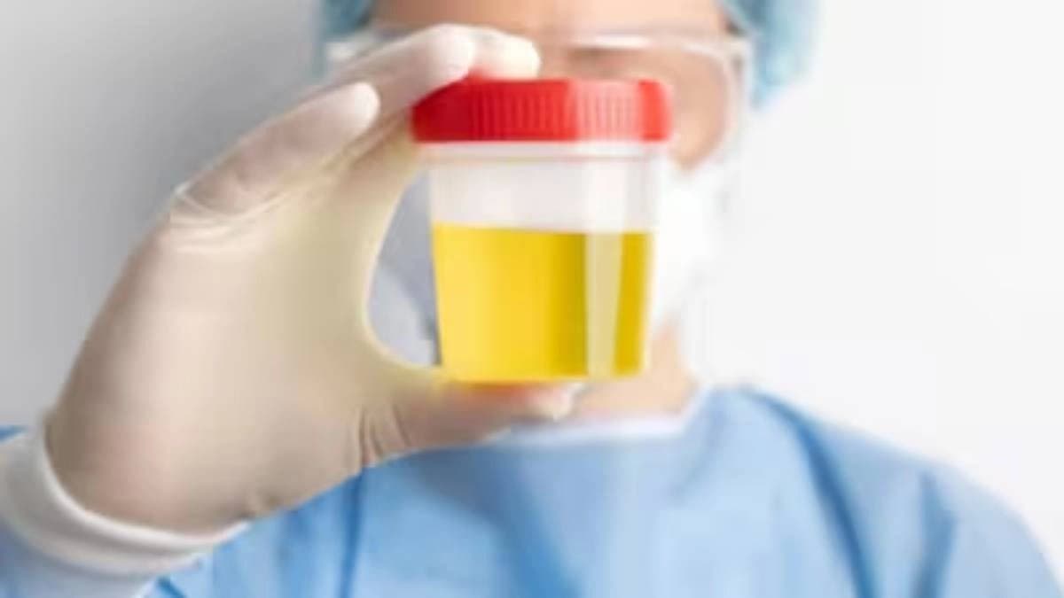  5 Ways Urine Reveals Serious Health Problems