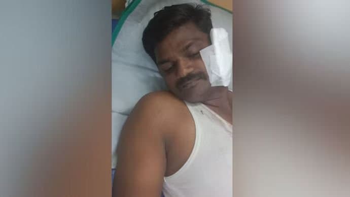 Attack :  মোবাইল ছিনতাইবাজ ধরতে গিয়ে আক্রান্ত পুলিশ 