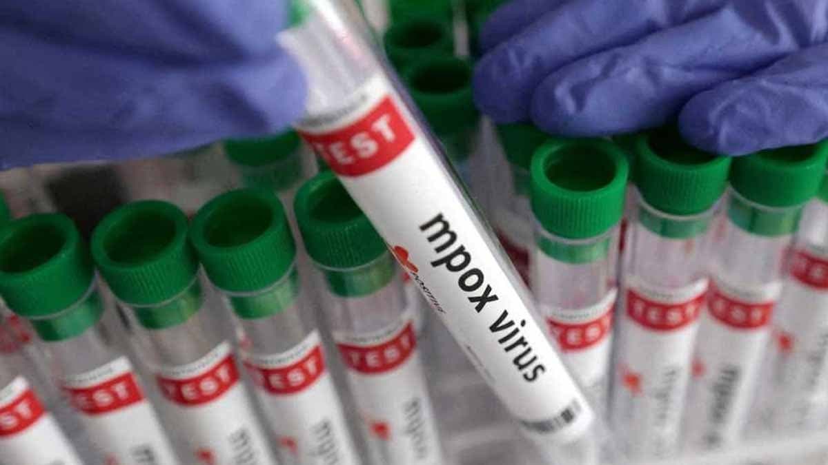 To Handle Mpox Cases Identify Facilities Trained People gnr