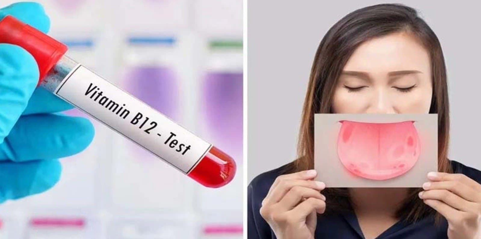 You should not ignore these symptoms Vitamin B12 Deficiency LIF