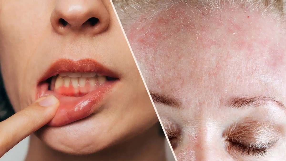 DIY health Tips: five symptoms of Vitamin C deficiency