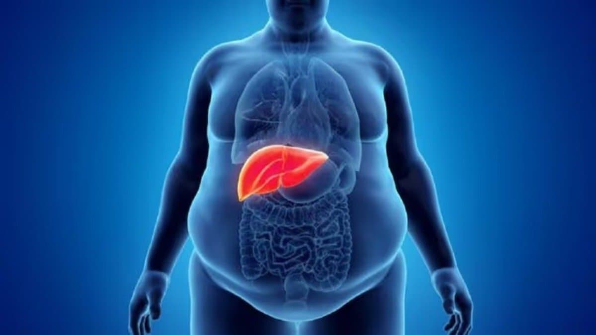 Be alert of these fatty liver symptoms lif 