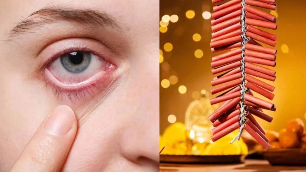 Diwali 2025 What precautions should take to keep eyes safe during Kalipuja 