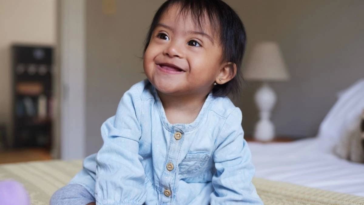 Could Down Syndrome be eliminated as Scientists found a way to delete the extra chromosome linked to this genetic disorder
